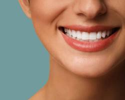 Αισθητική οδοντιατρική - Κοσμητική οδοντιατρική Αγίοι Ανάργυροι