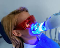 Λεύκανση δοντιών - Αισθητική λεύκανση οδοντίατρος Αγίοι Ανάργυροι